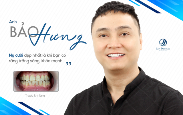 Bọc sứ thẩm mỹ là phương pháp giúp khắc phục mọi khuyết điểm của răng cho hàm răng đẹp và khỏe hơn