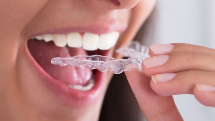 Liệt kê 7 phương pháp trị nghiến răng cực kì đơn giản tại nhà