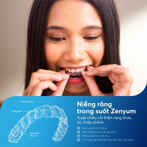 Niềng răng Zenyum Jun Dental