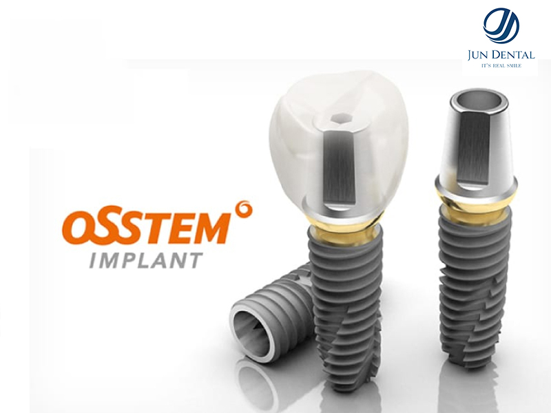 Osstem là dòng trụ implant dẫn đầu thị phần tại Hàn Quốc, được giới chuyên gia đánh giá là 1 trong các loại implant lành tính với cơ thể, không gây kích ứng